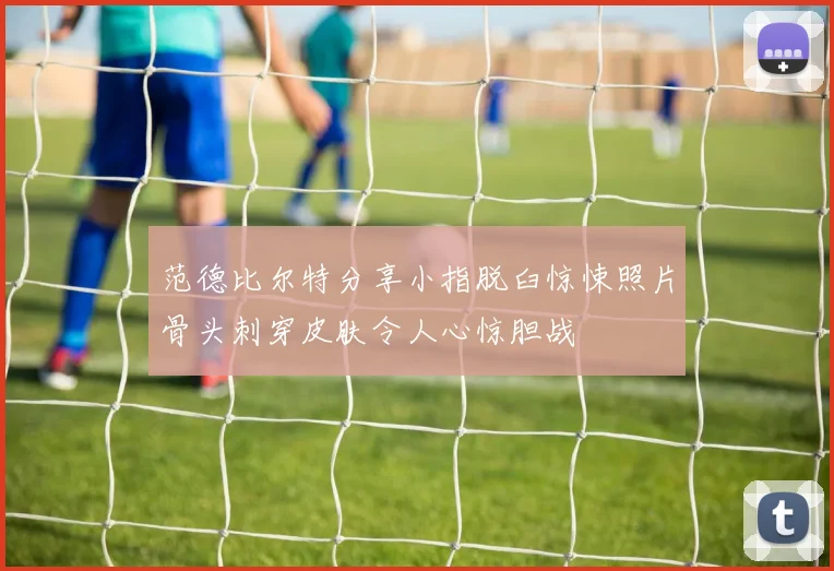 范德比尔特分享小指脱臼惊悚照片骨头刺穿皮肤令人心惊胆战
